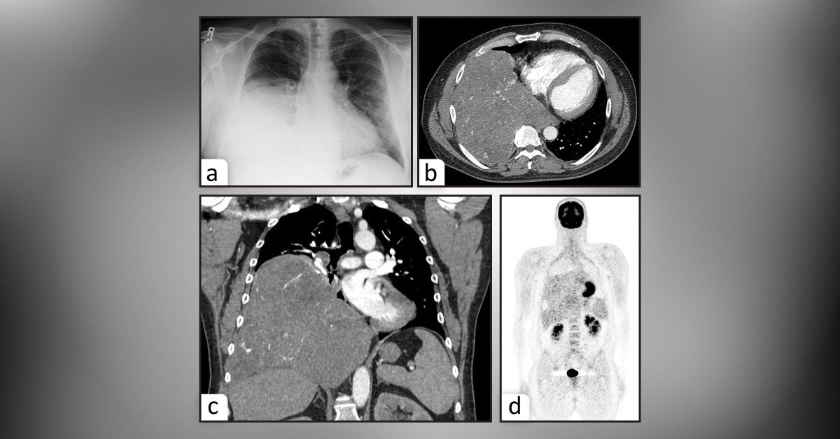 Spot the Diagnosis