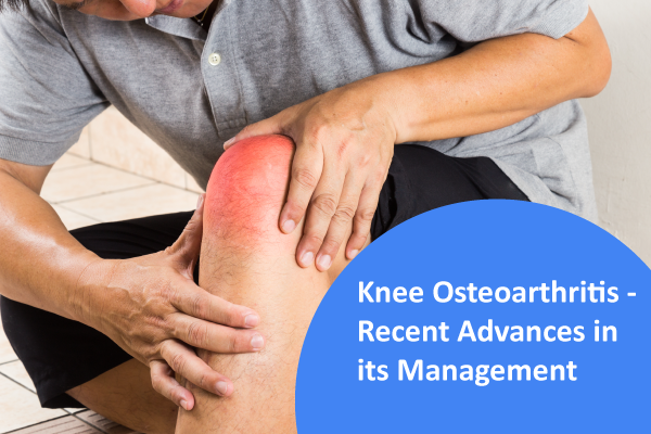 Knee Osteoarthritis - Recent Advances in its Management