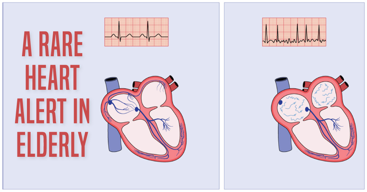 A Rare Heart Alert in an Elderly Man