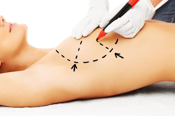 Essentials of Breast Surgery