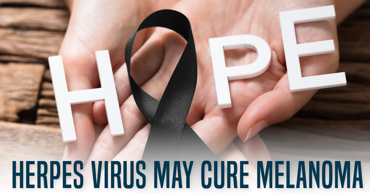 Curing Late Stage Melanoma: The Startling Role of Herpes Virus