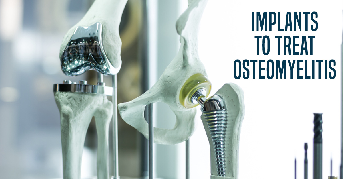 New Approach To Treat Osteomyelitis