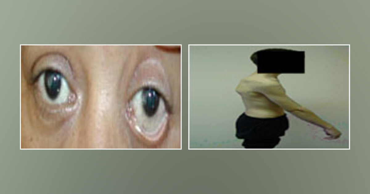 Case of a Young Boy with Severe Hip Pain