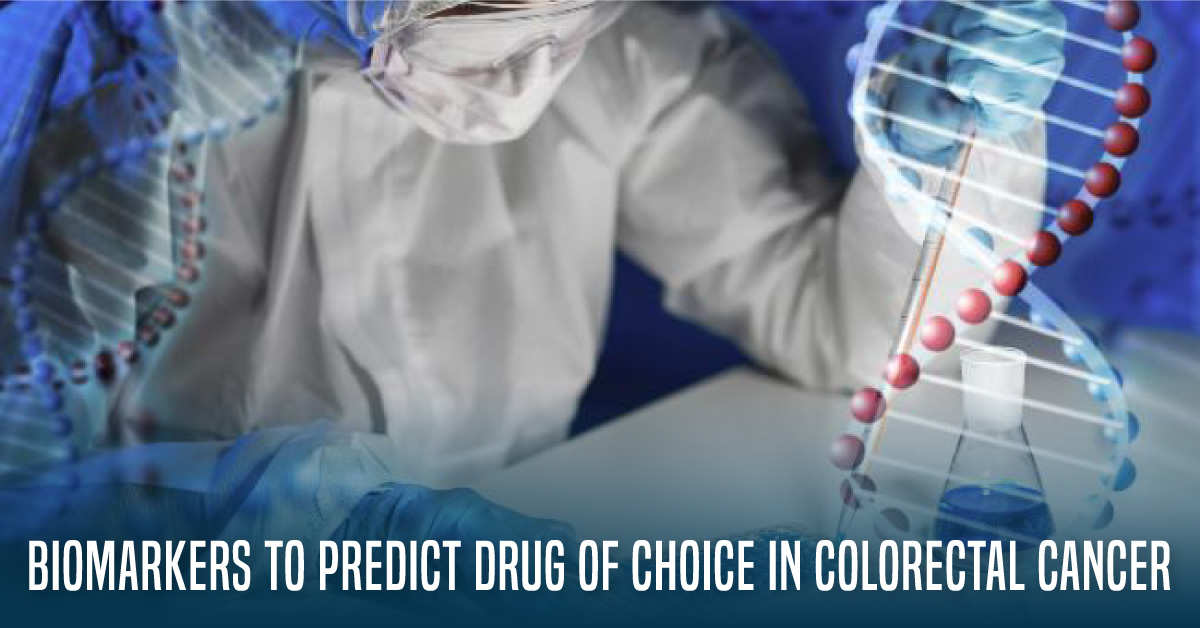 Biomarkers To Predict Drug of Choice In Colorectal Cancer