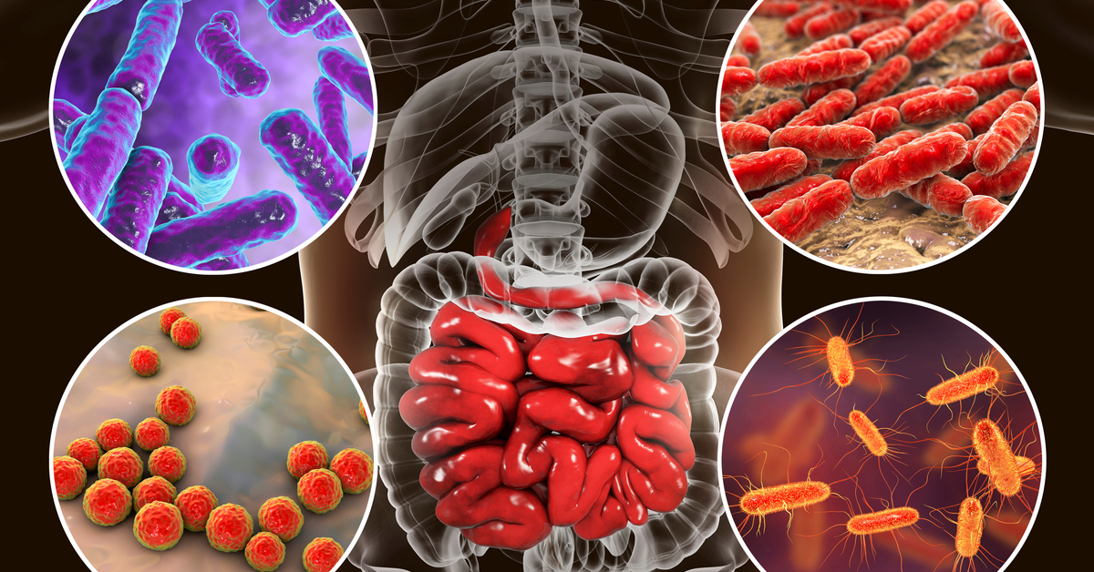 More Evidence Links Gut Bacteria To Dementia