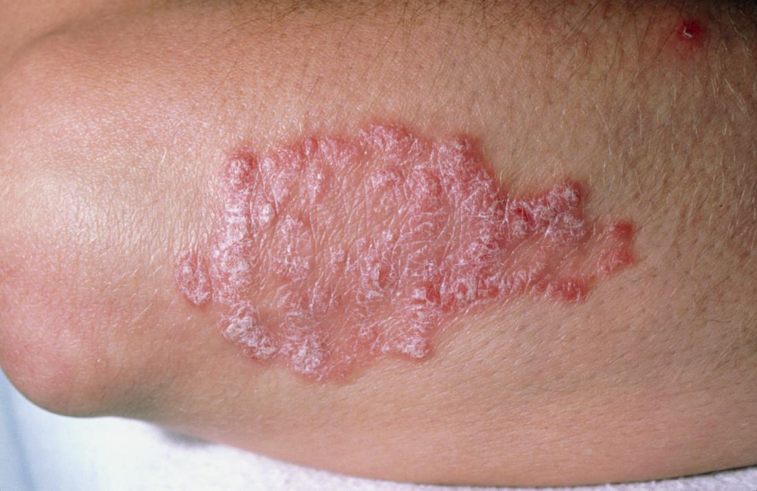 What Systemic Diseases Can Be Ruled Out?