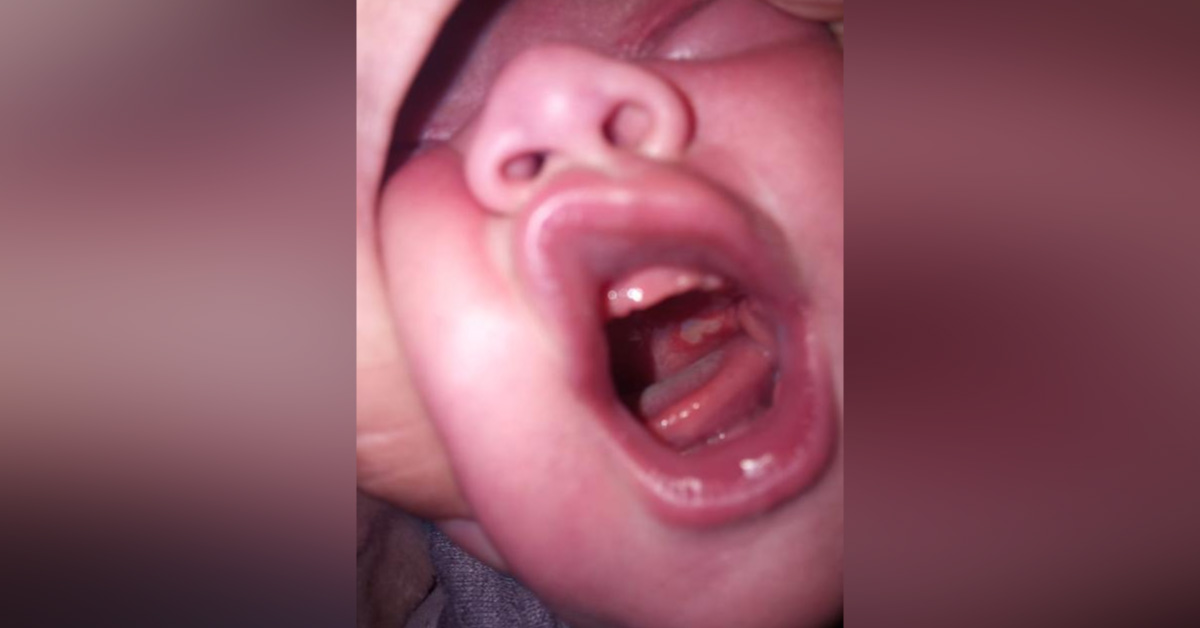 Spot Diagnosis