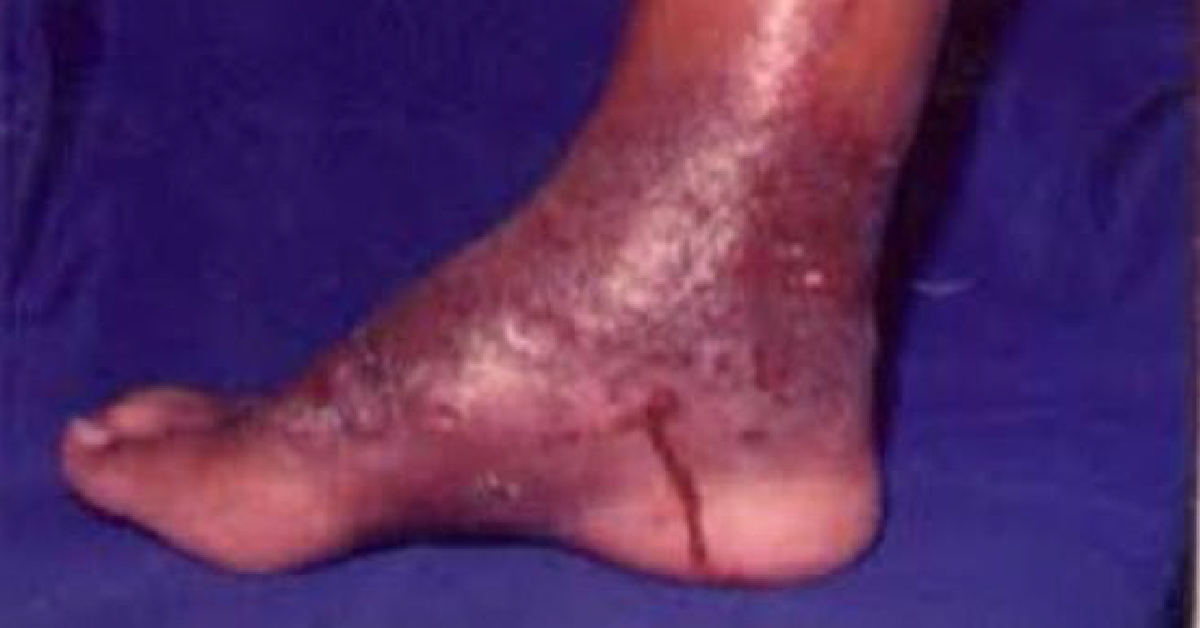 Please Diagnose The Condition And Discuss Treatment