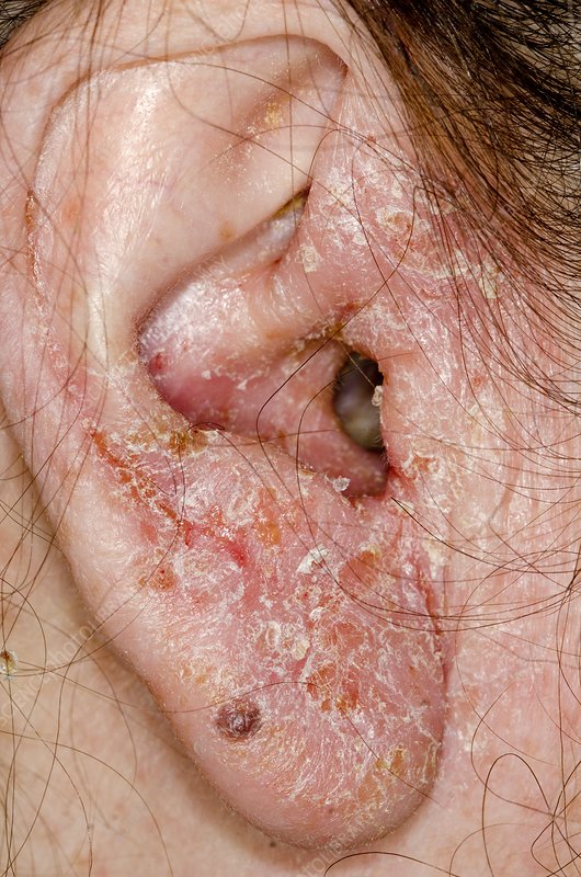 Spot The Diagnosis And Discuss The Treatment If Needed