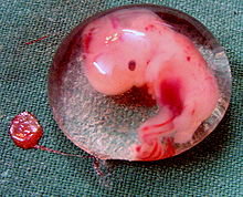 Past Abortion