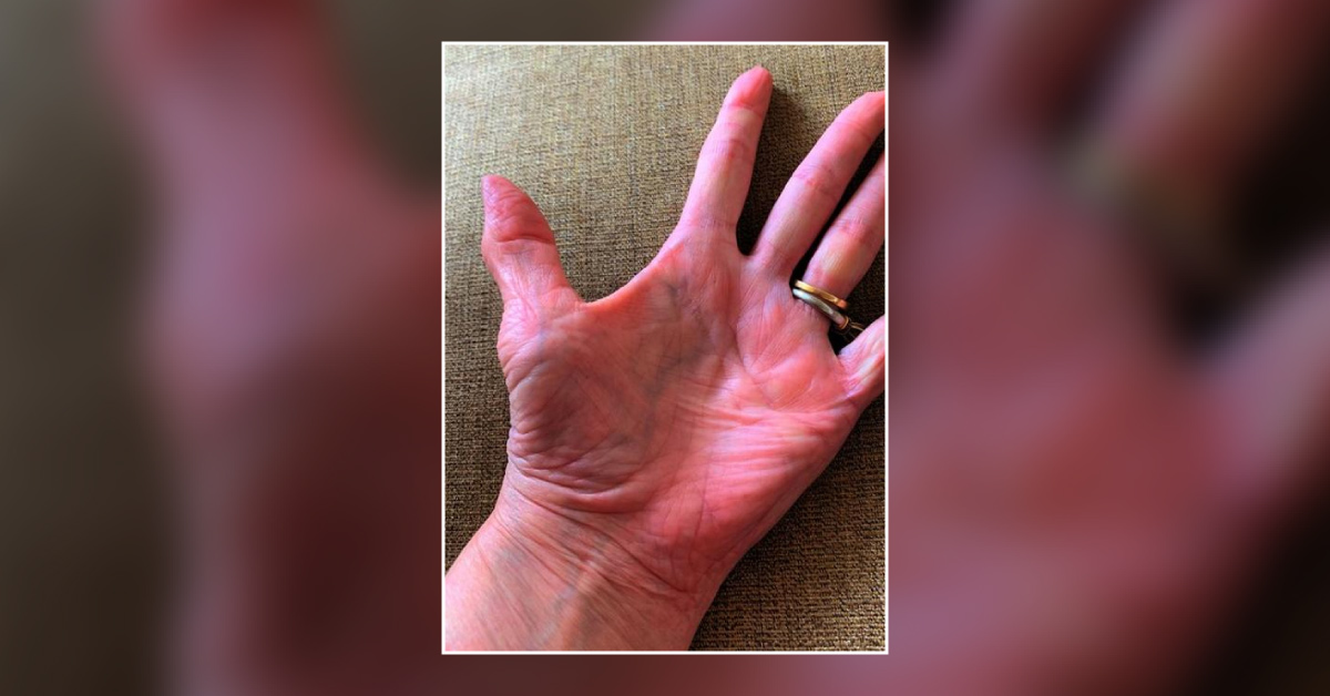 Spot The Diagnosis