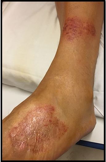Spot The Diagnosis Of Lesion