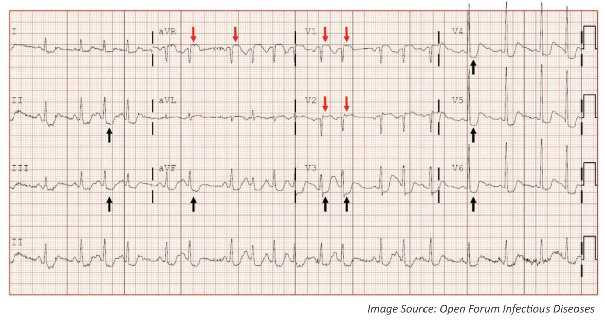 Diagnose This Rabies Complication