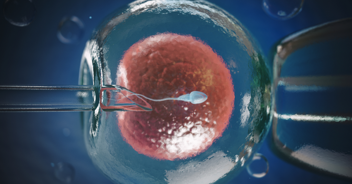 Bilateral Total Salpingectomy Or Cornual Salpingectomy  - In Place Of  - Traditional Lap Tubal Ligation/Open Tubal Ligation, Atleast In High Risk