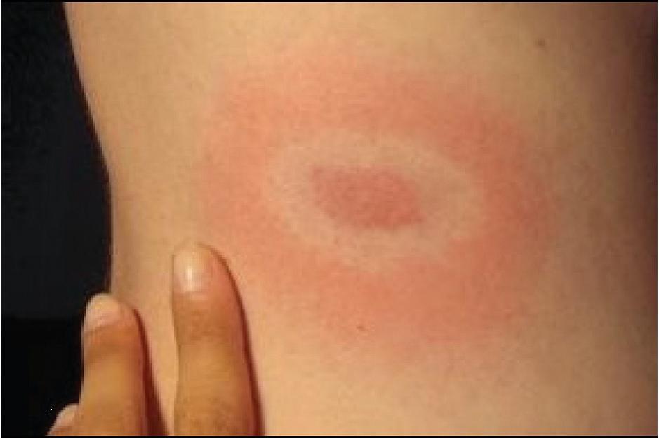 Please Diagnose This Disease