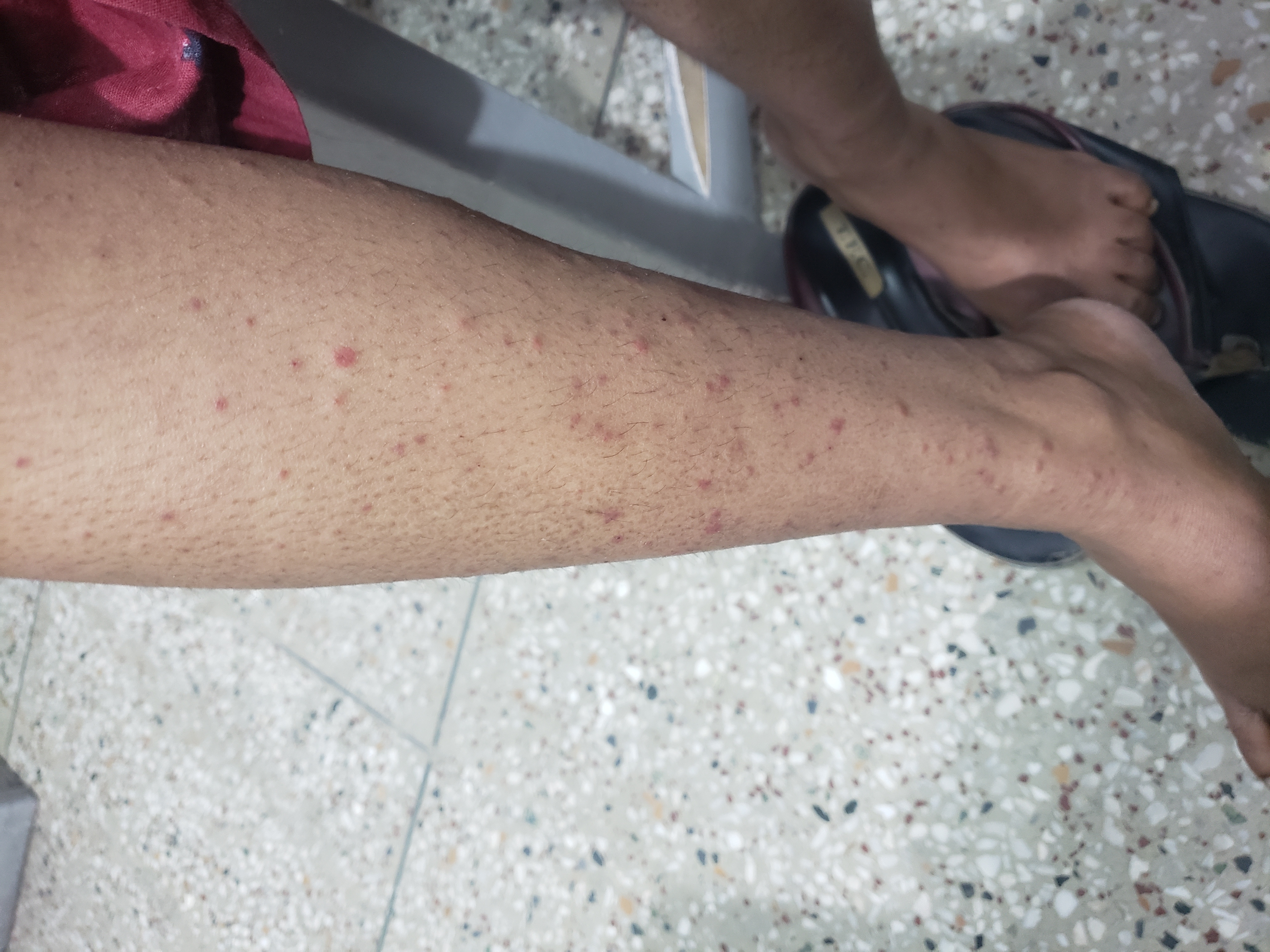 What Is This Skin Problem?