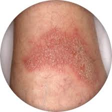 Please Diagnose The Condition