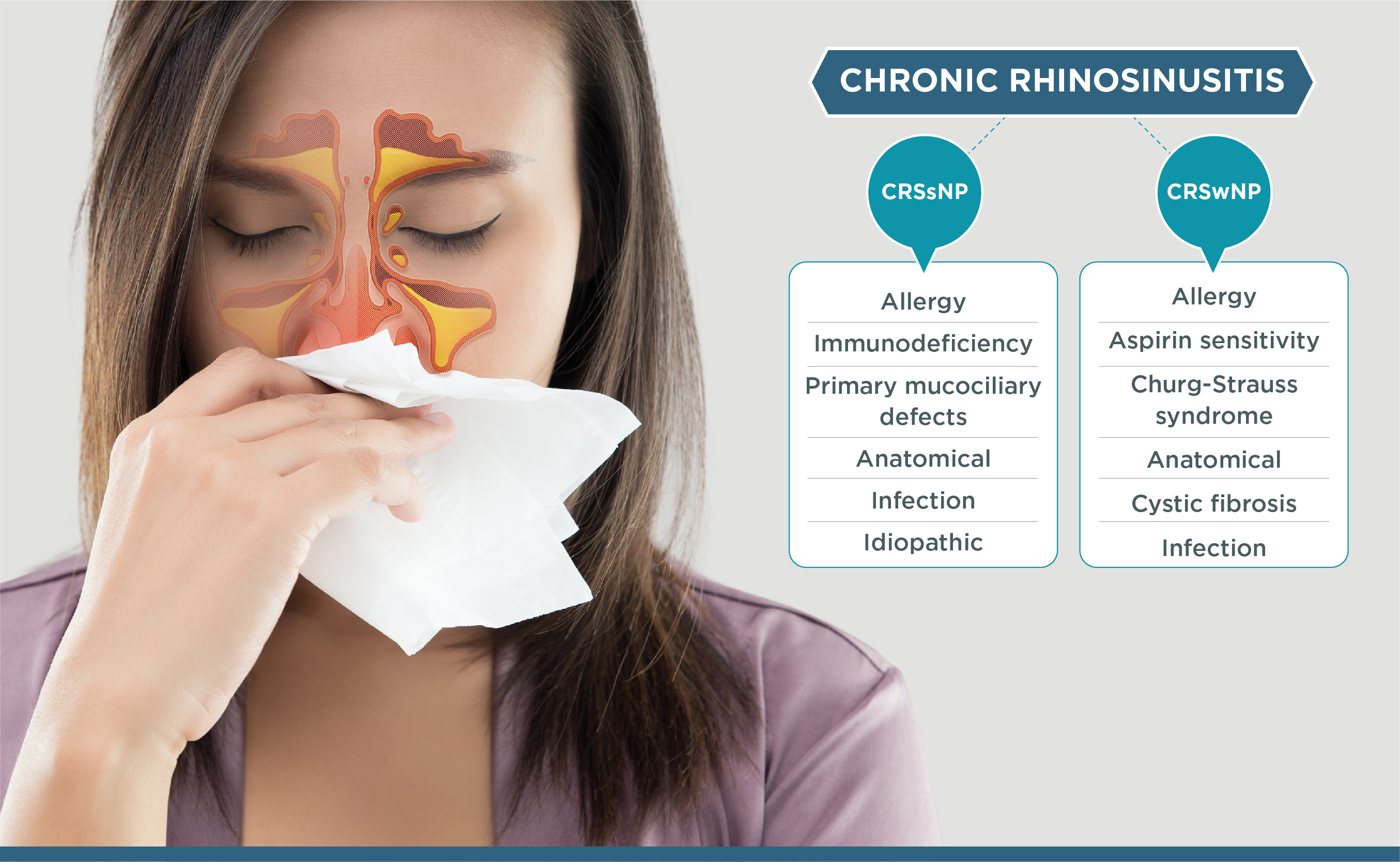 Chronic Rhinosinusitis And Nasal Congestion – Clinical Importance