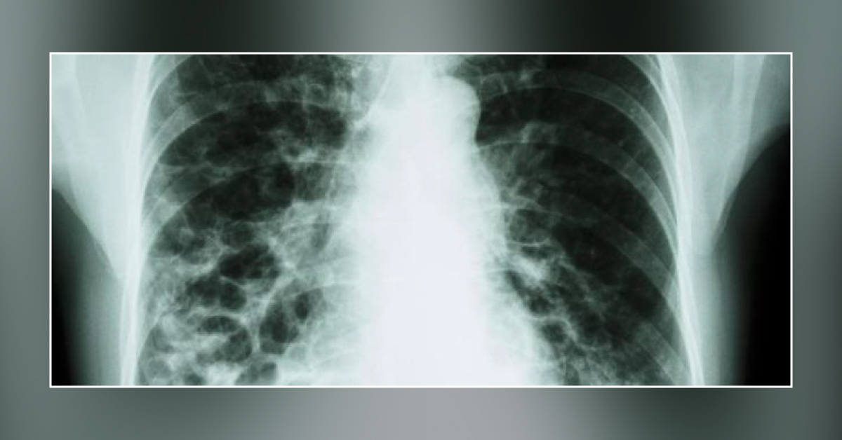 Spot The Diagnosis- Discuss The Treatment If Needed