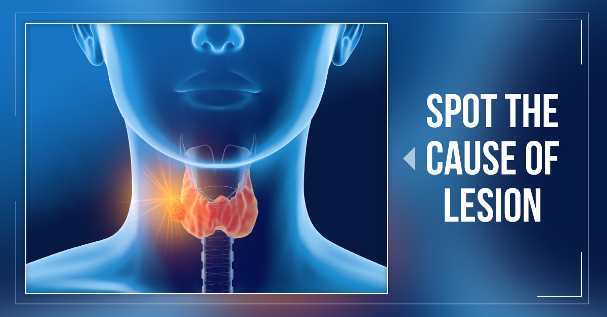 Diagnose The Lesions In Parathyroid Gland