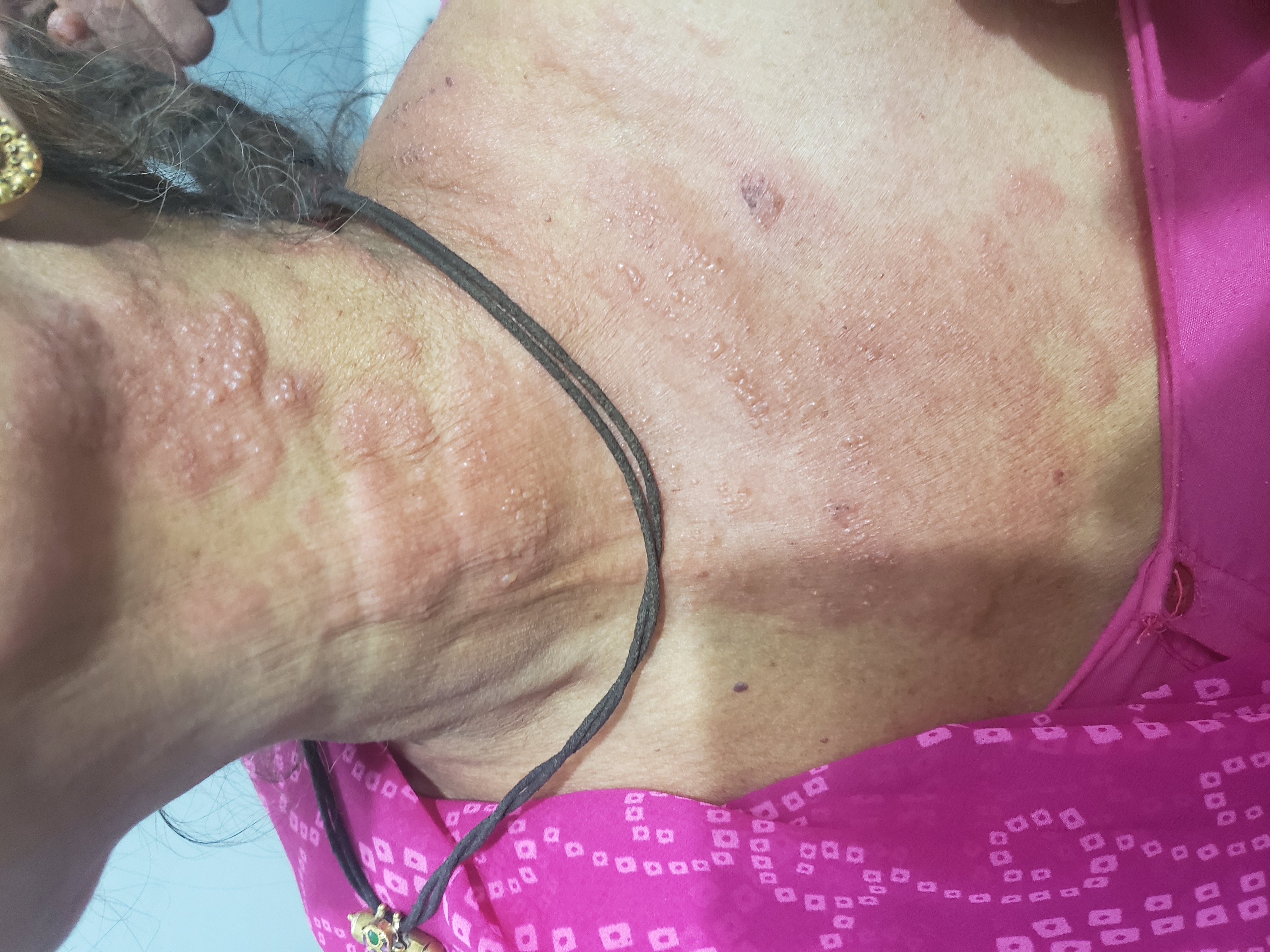 Diagnose The Lesions