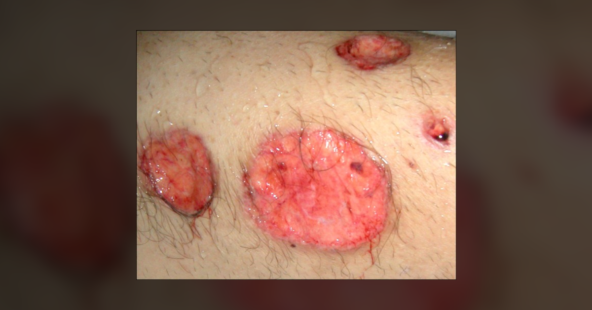 Identify These Lesions