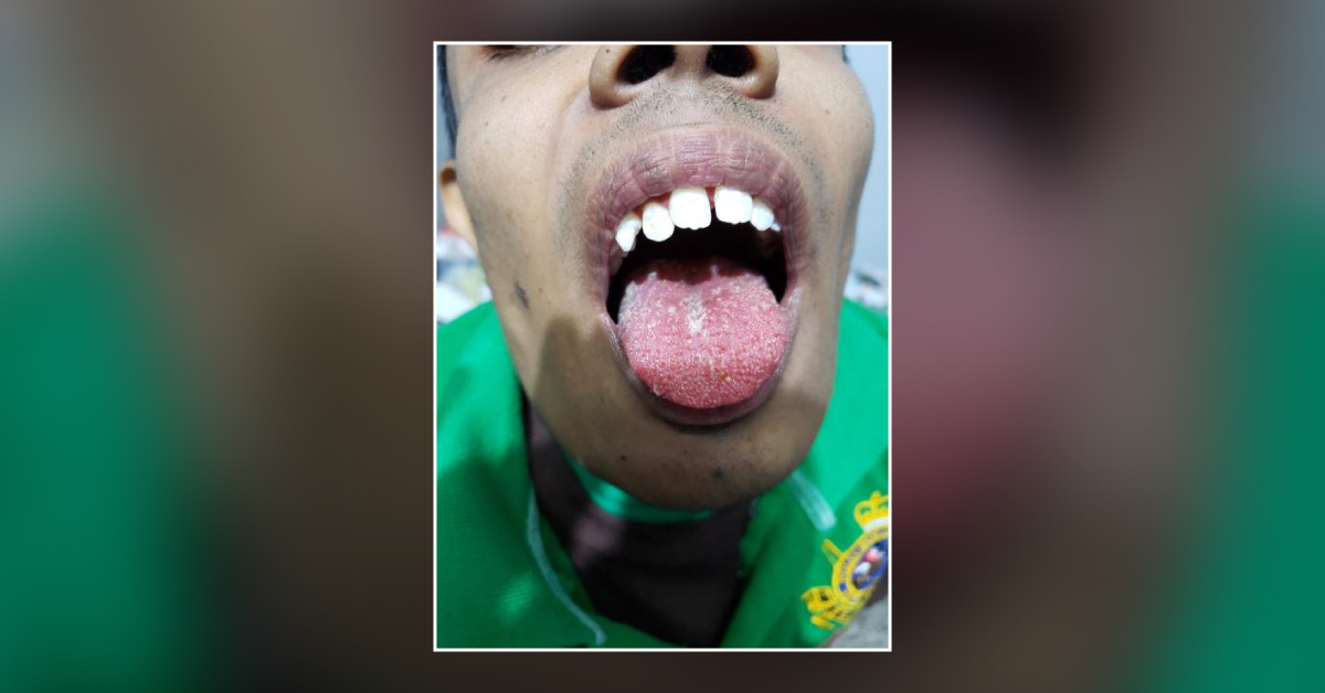 Can This Patient Be Labelled As MIDD?