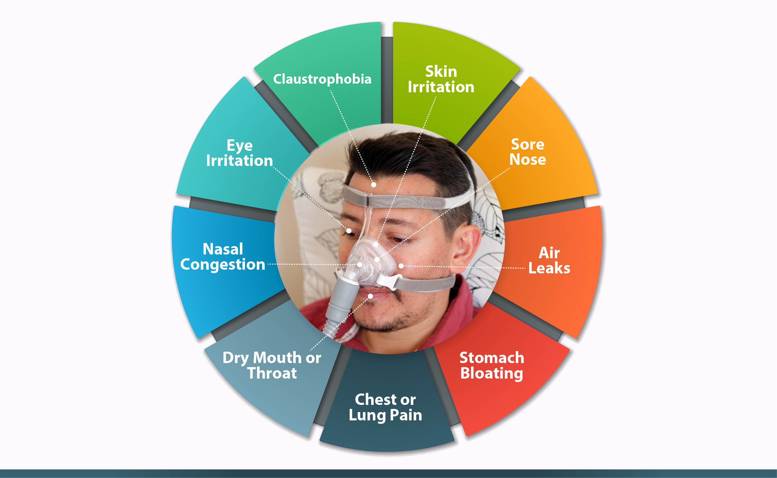 Nasal Congestion – A Common Side Effect in Patients Treated with Continuous Positive Airway Pressure