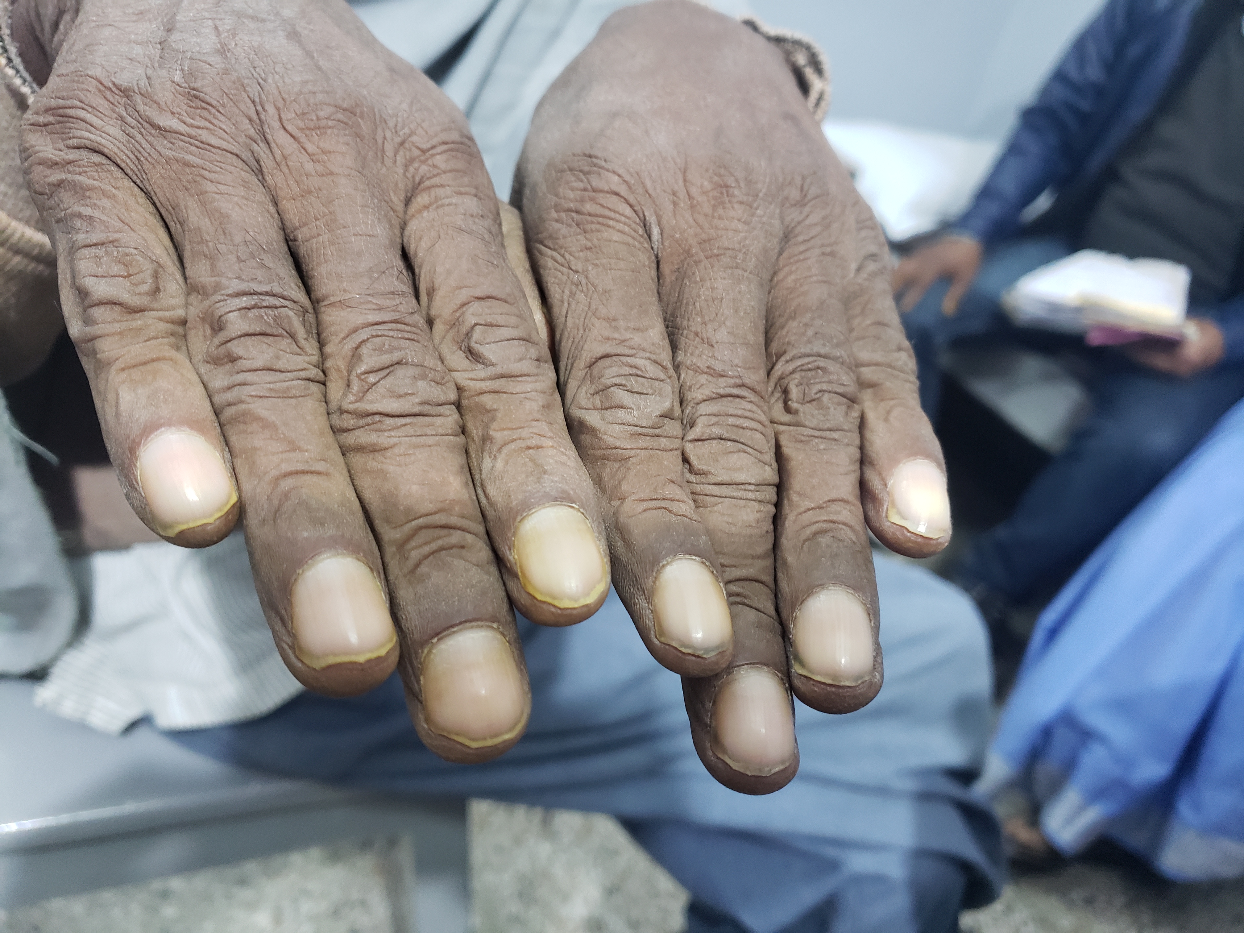 Diagnosis For This Patient Required!