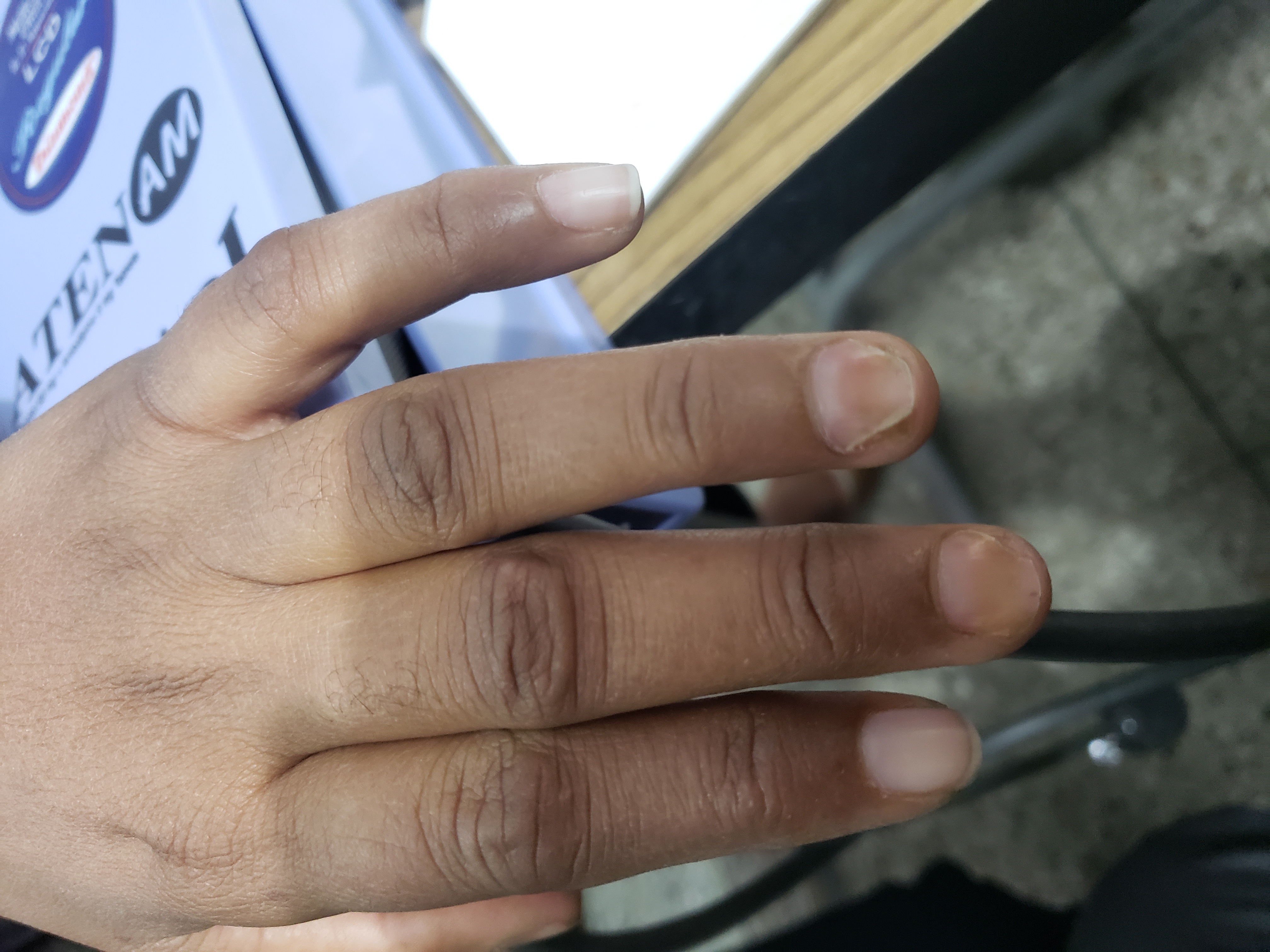 What Is This Special Type Of Pitting Over Nails ?
