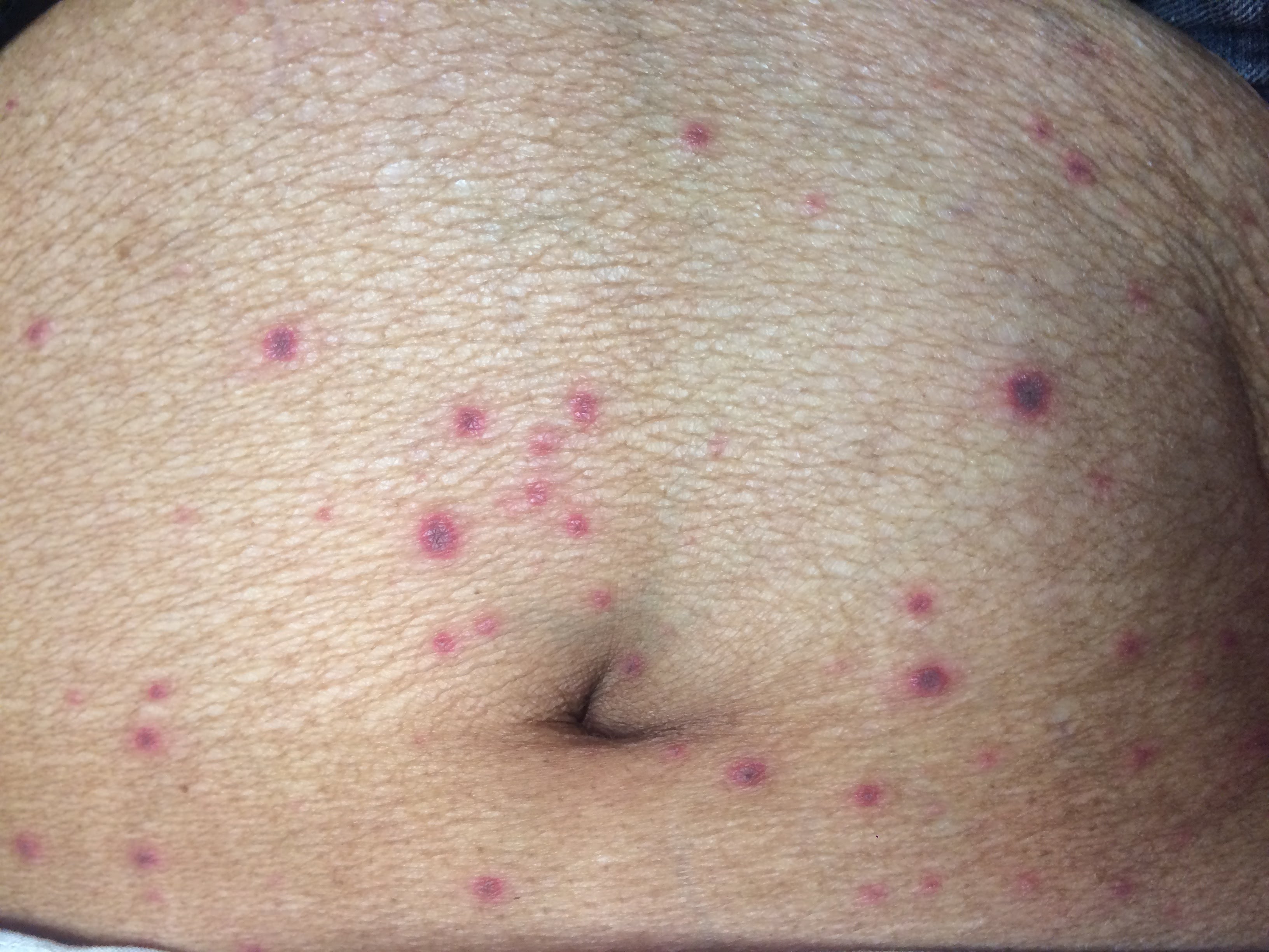 Please Identify The Disease