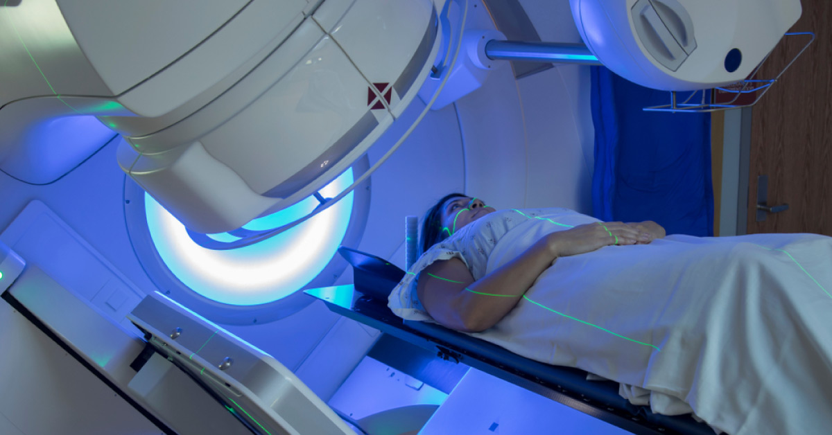 Ocular Side Effects Of Radiations