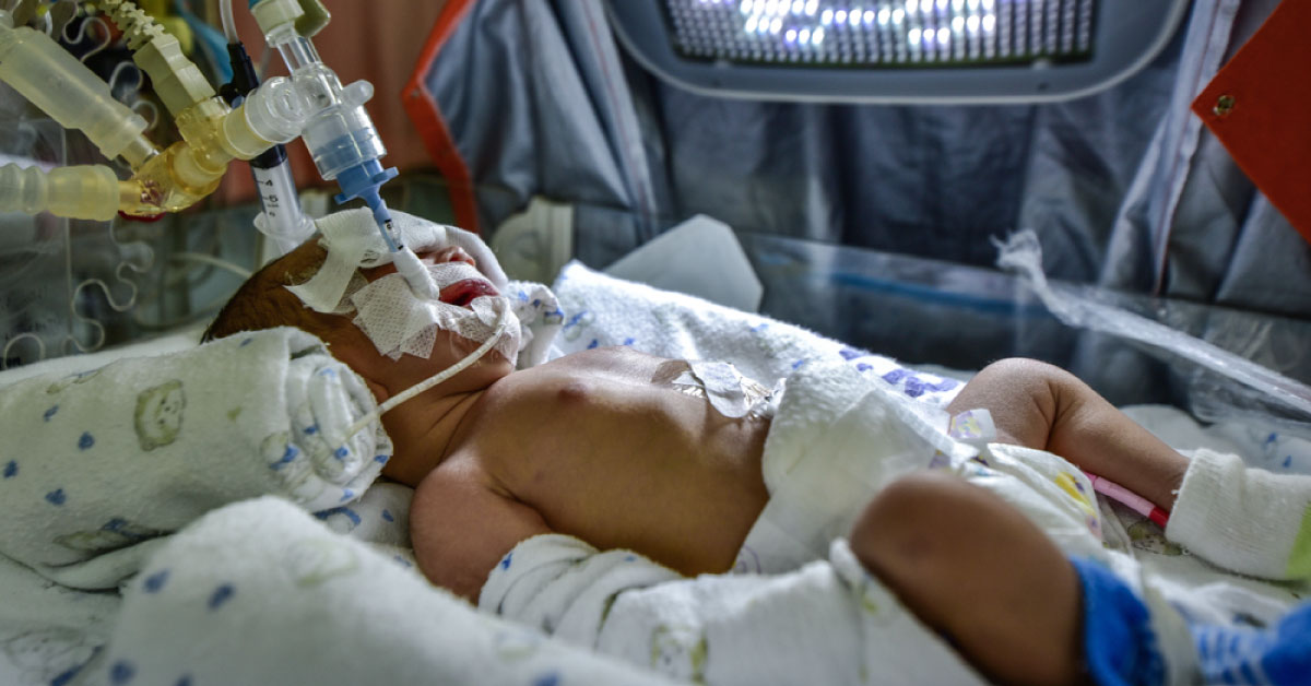 Intratracheal/Endo Tracheal Instillation Of N-Acetyl Cysteine + Surfactant In Meconium Aspiration Syndrome, ARDS, Acute Inhalational Lung Injury