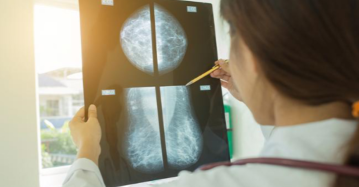 Clinicians should avoid these 5 procedures in case of benign breast diseases