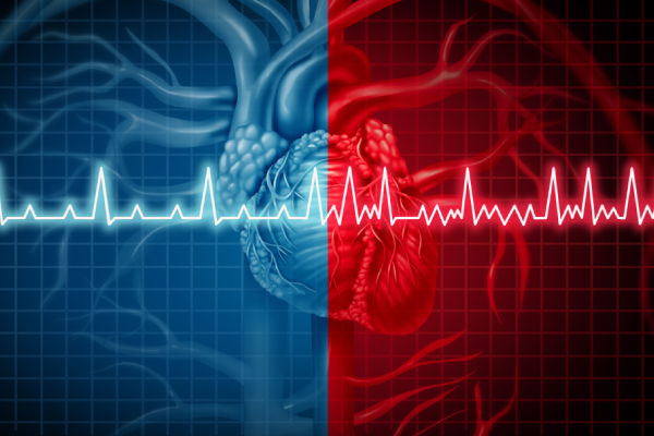 ECG: Understanding Arrhythmias Better