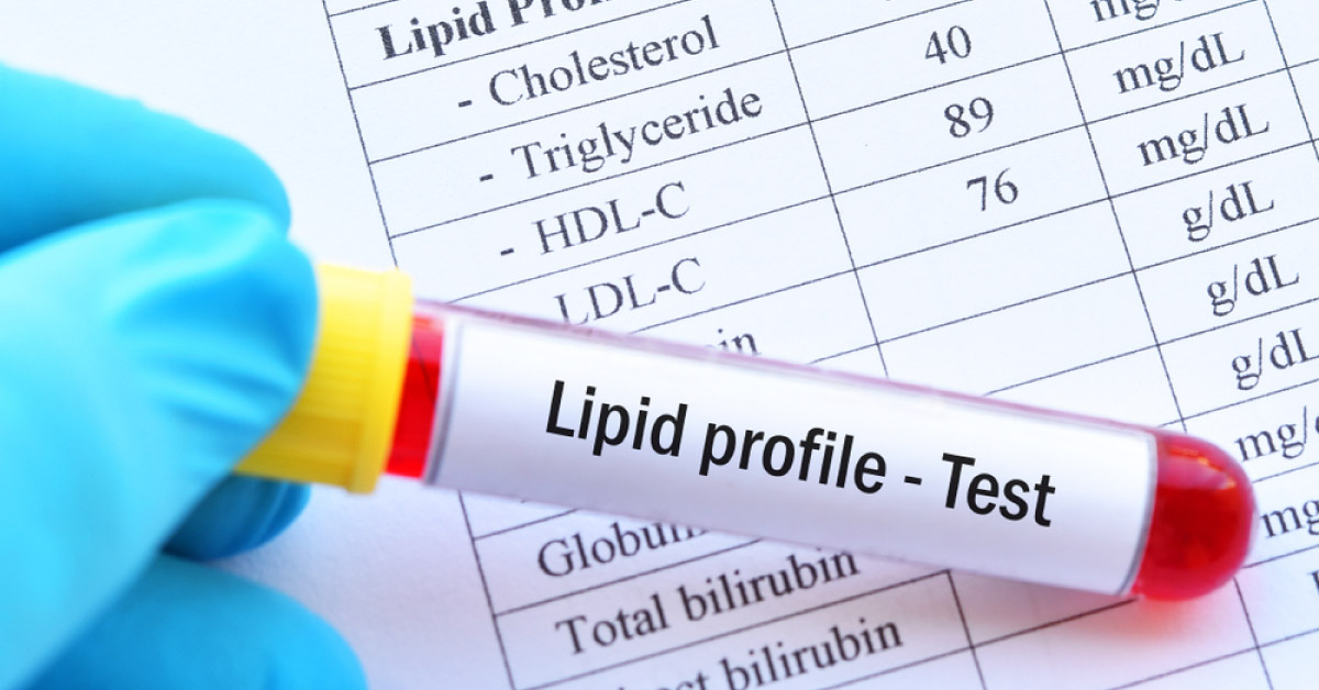 Brief Post On Some Of The Ocular Manifestations Of Hyperlipidaemia