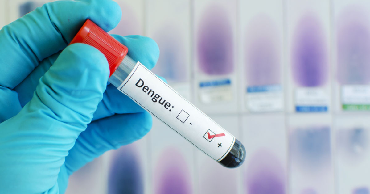 Ocular Manifestations Of Dengue Fever