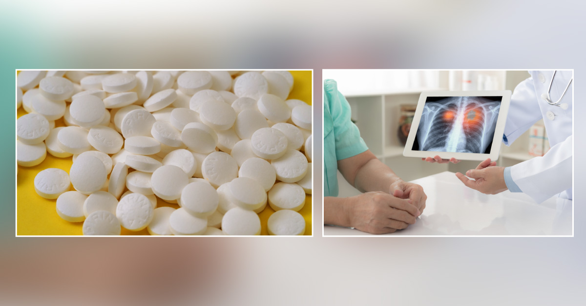 Association Of Long-Term Use Of Low-Dose Aspirin As Chemoprevention With Risk Of Lung Cancer