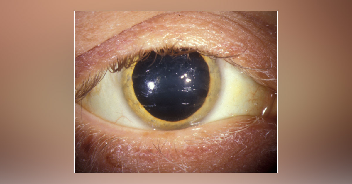 Diagnose the Underlying Condition