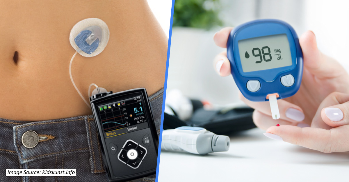 Artificial Pancreas To Boost Diabetes Treatment