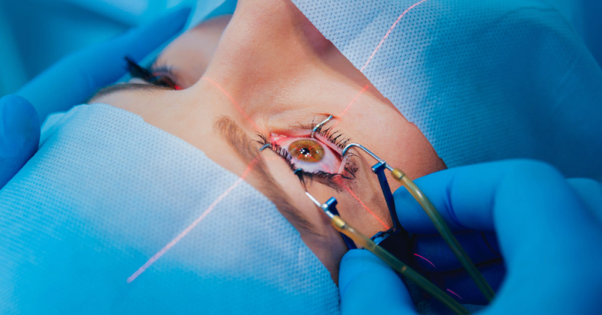 Scenario Of Lasik