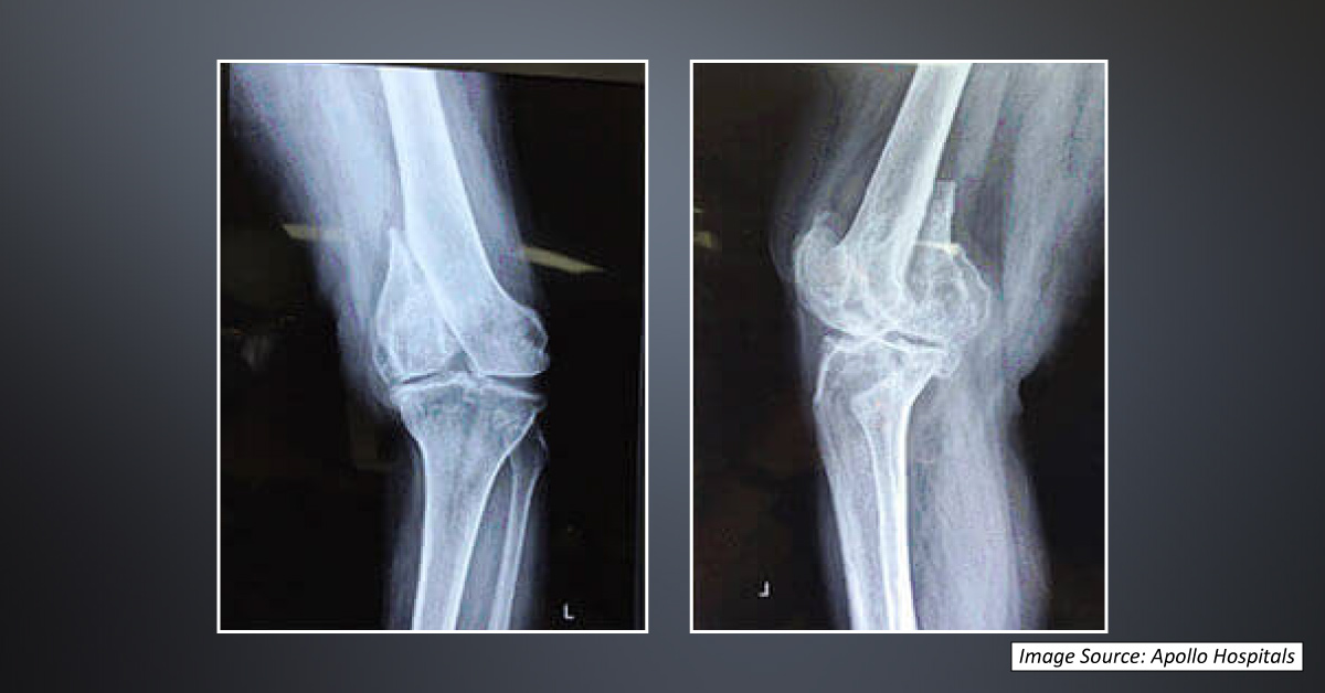 Interpret The X-Ray