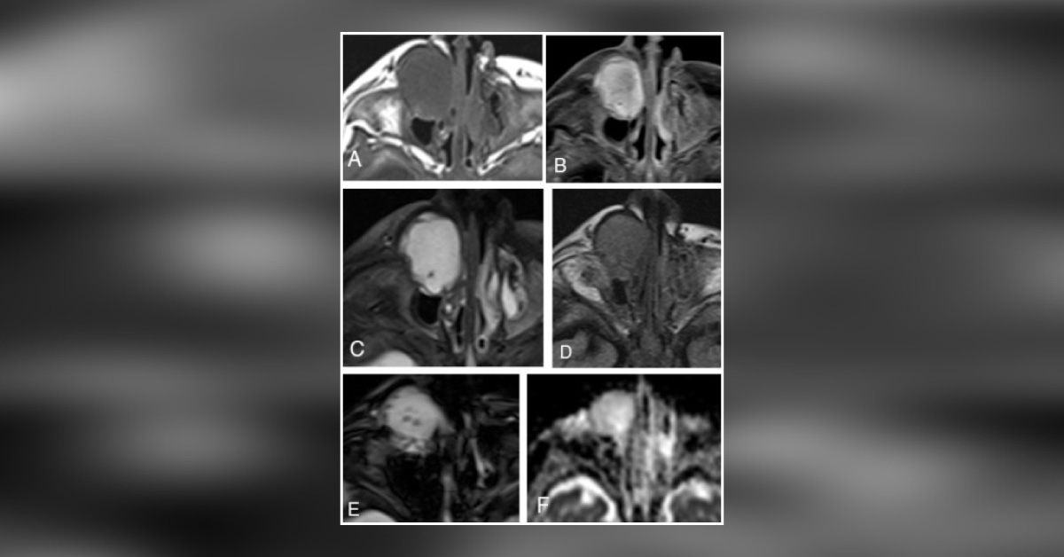 Can You Diagnose This Infant's Condition?