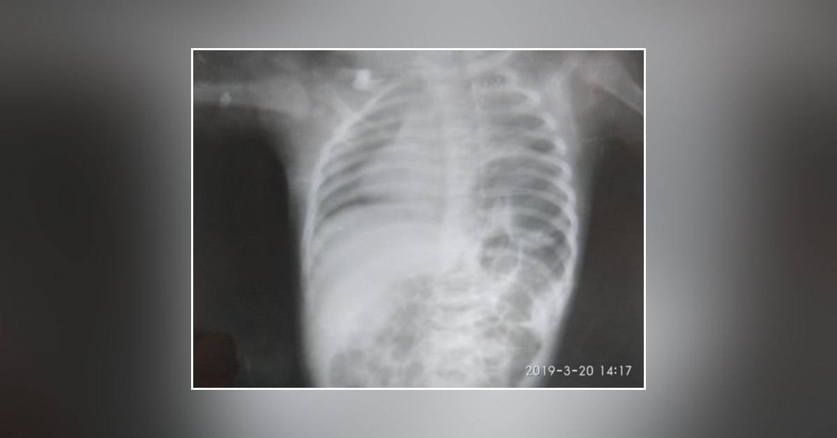 Comment On X-ray Of 4 Months Old