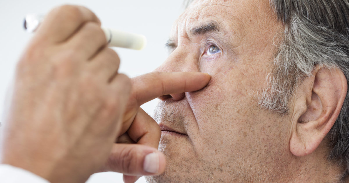 Ocular Side Effects Of Prostaglandin Analogues