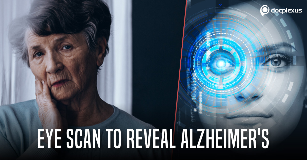 Eyes- Key To Reveal Alzheimer’s Earlier