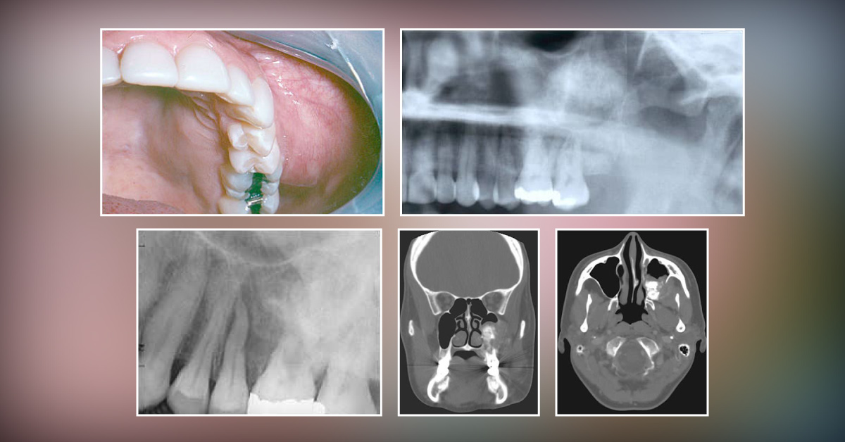 Diagnose the Cause of Facial Asymmetry