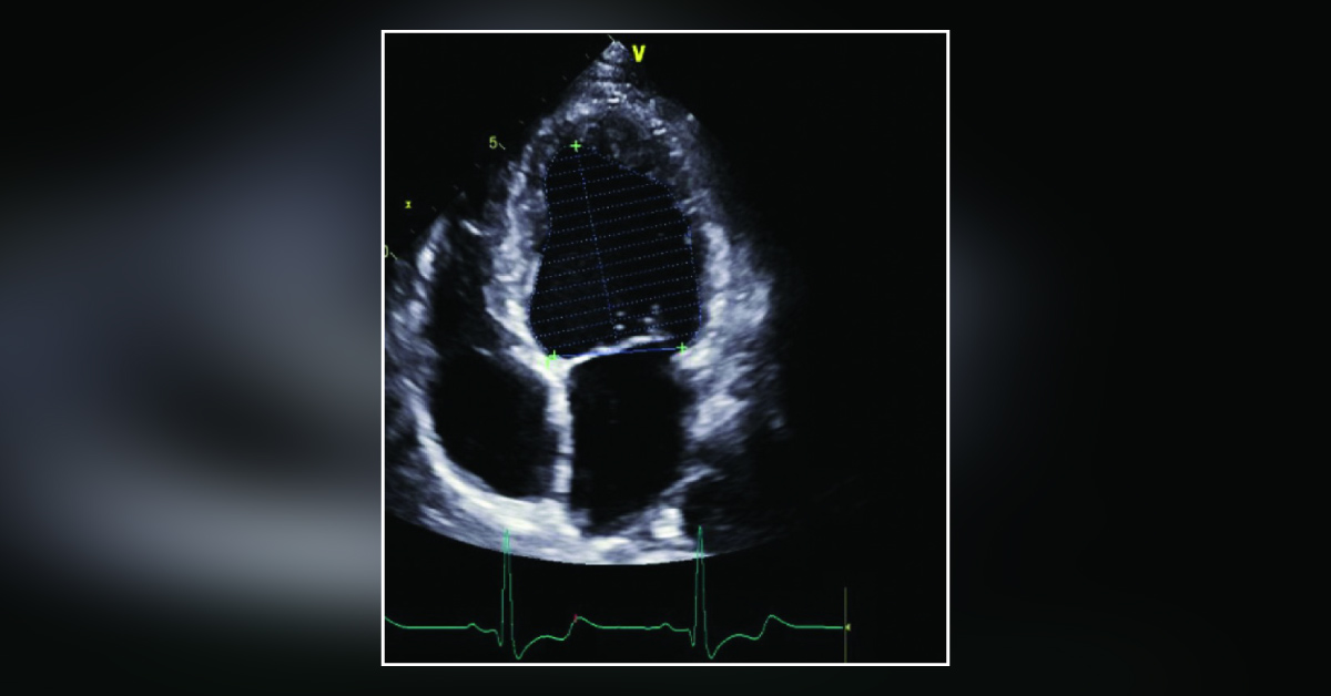 Dyspnea and Fatigue: Can You Identify the Defect?