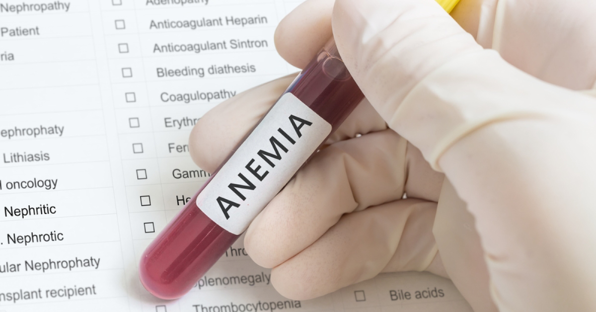 Some Of The Ocular Manifestations Of Anaemia
