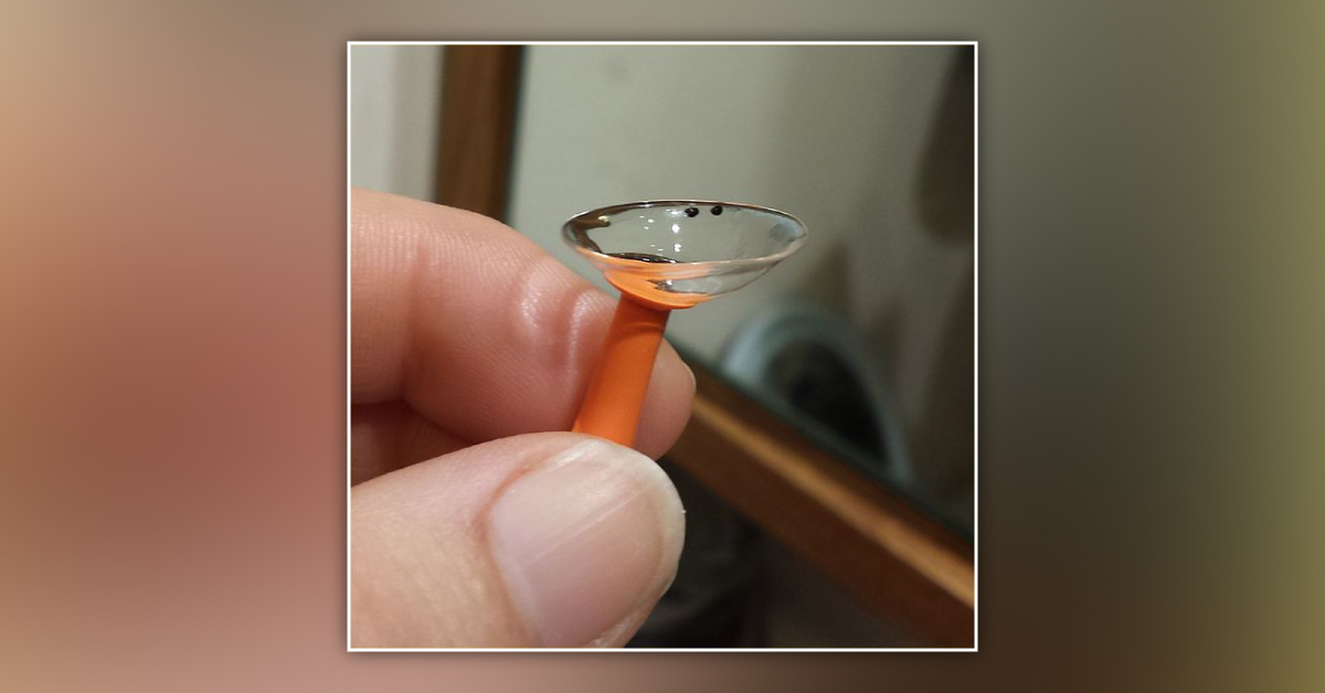 Scleral Lens Will Replace Demand Off Cornea To Correct Blindness